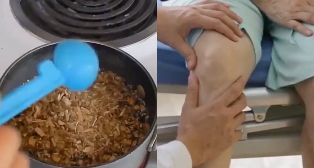 Dr. Oz's joints restoration breakthrough video
